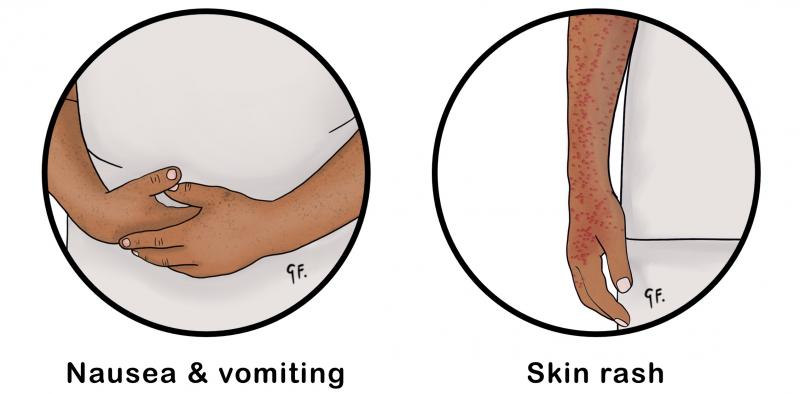 Illustration showing some of the symptoms of dengue fever in children