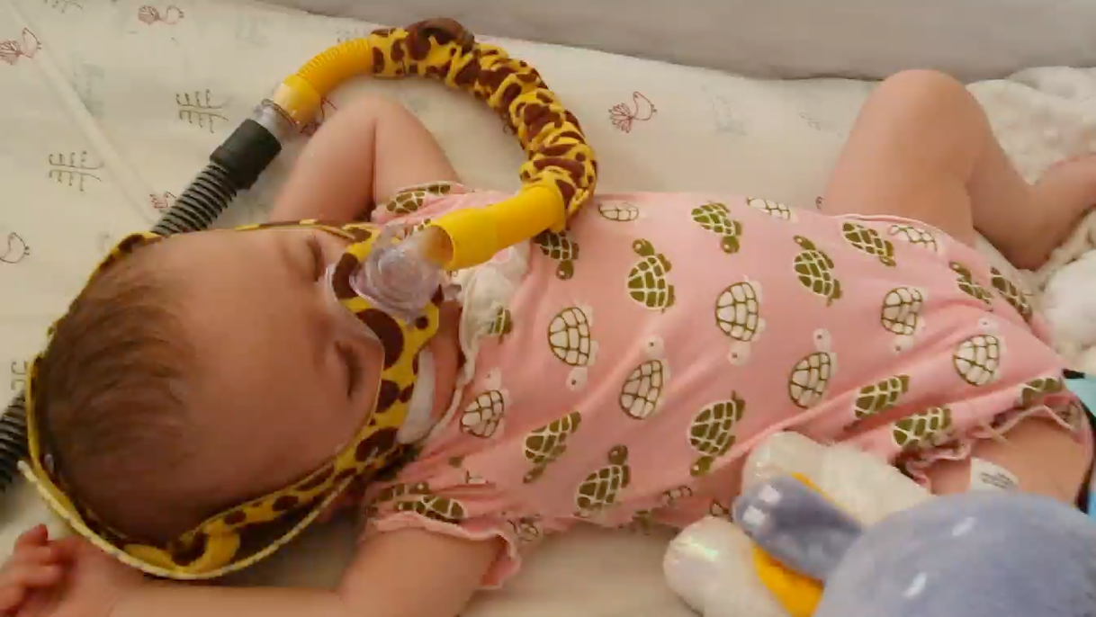 Baby sleeping with a CPAP machine